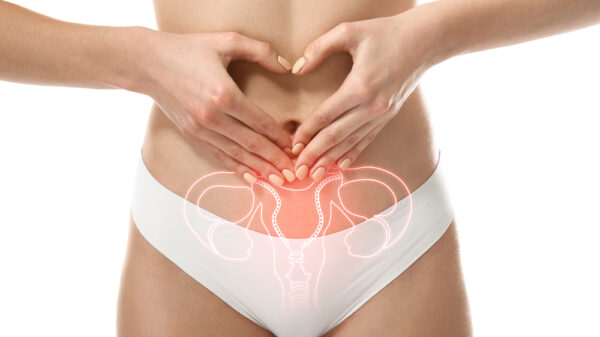 Endometriosi: comprendere, diagnosticare e curare per prevenire l'infertilità