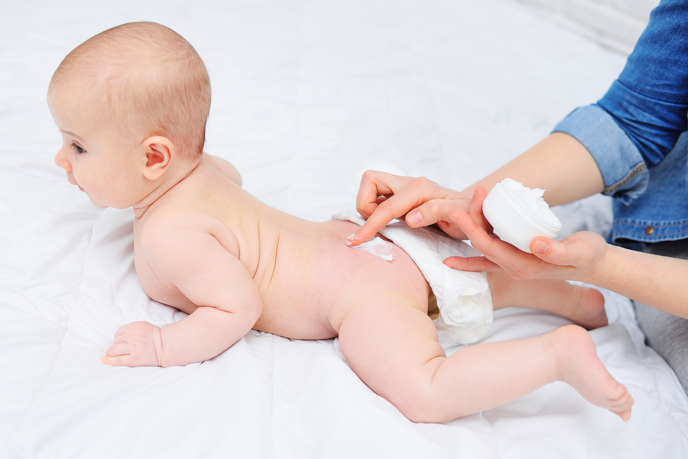 Dermatite da pannolino: come prevenirla e alleviarla per il benessere del bambino