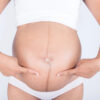 La linea nigra in gravidanza