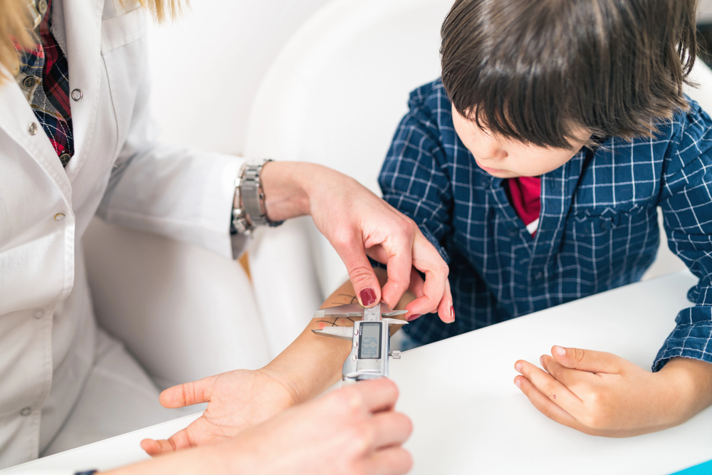 Allergie alimentari in età pediatrica: una sfida crescente per la salute infantile